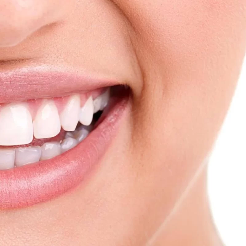 Invisalign ή Σιδεράκια